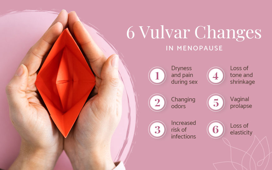 6 vulvular changes in menopause