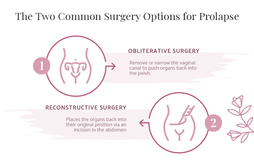 There are two common surgery options for prolapse