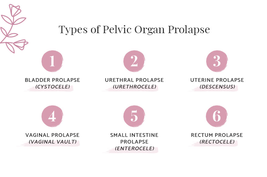 types of pelvic organ prolapse